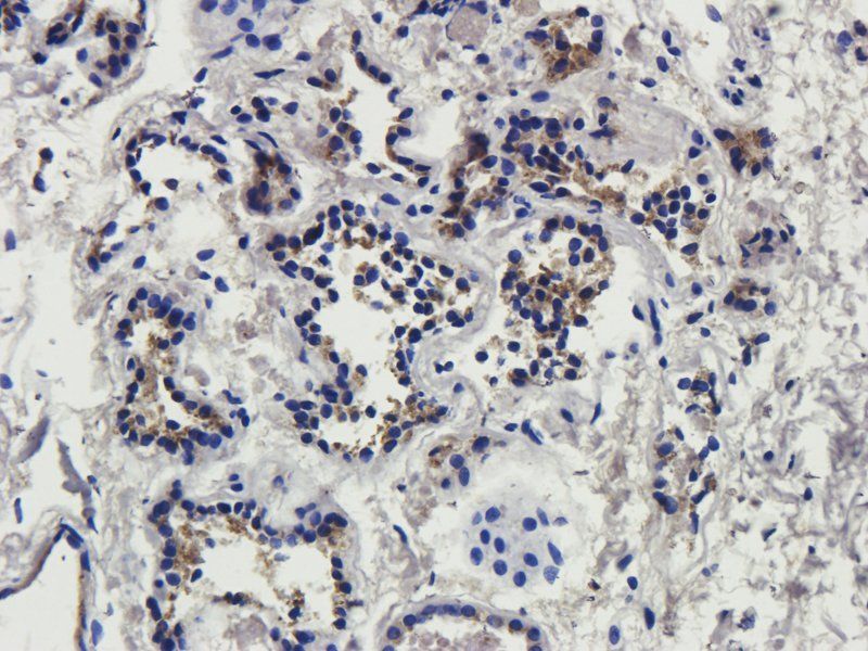 IL4 Rabbit Polyclonal Antibody