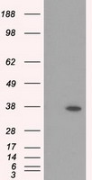 IL6 Antibody