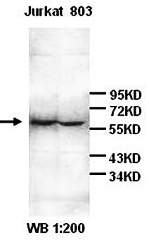 IL-6R Rabbit Polyclonal Antibody