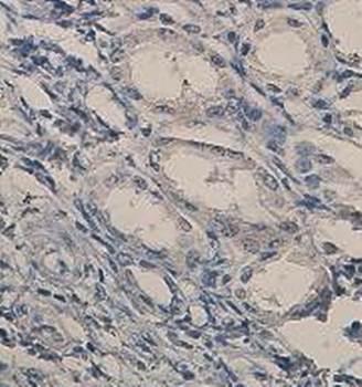 IL-6R Rabbit Polyclonal Antibody