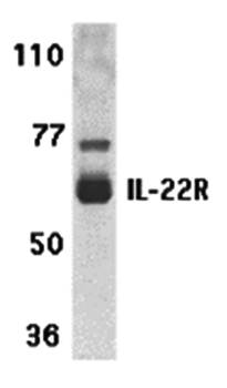 IL-22 Receptor Antibody