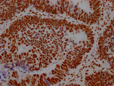 ILF3 Antibody