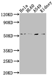 ILK Antibody