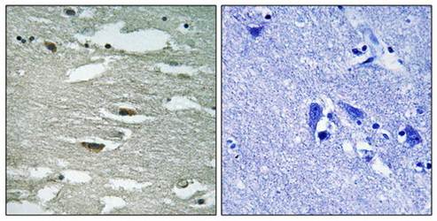 ILK (Phospho-Ser246) Antibody