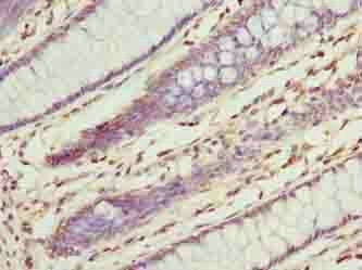 ILVBL Antibody