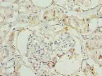 ILVBL Antibody