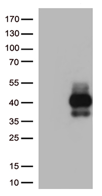 IGF2BP3 Antibody