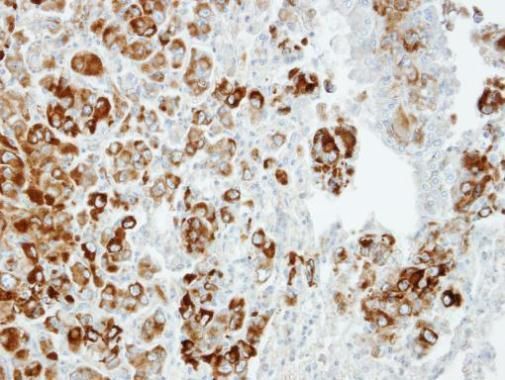 Importin 13 Rabbit Polyclonal Antibody