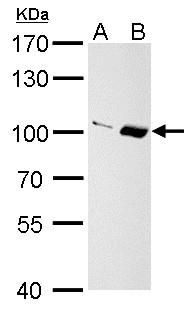 Importin 13 Rabbit Polyclonal Antibody