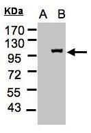 Importin 13 Rabbit Polyclonal Antibody