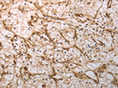 INHA Antibody