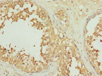 INHBC Antibody