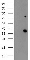 iNOS Antibody