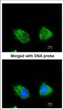 INPP1 Rabbit Polyclonal Antibody