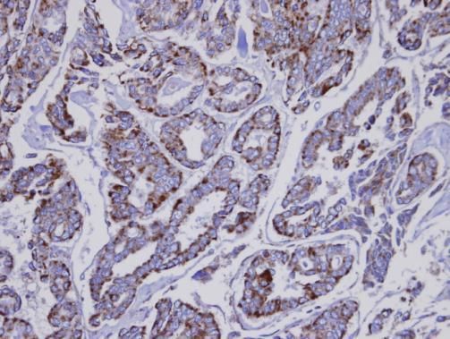INPP1 Rabbit Polyclonal Antibody