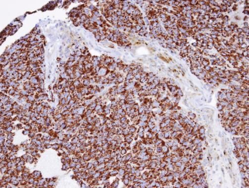 INPP1 Rabbit Polyclonal Antibody