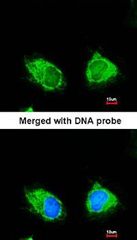 INPP1 antibody