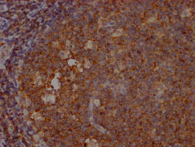INPP5D Antibody