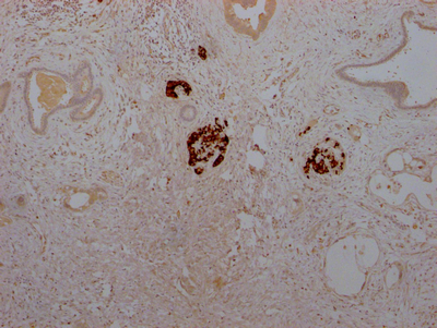 INS Antibody