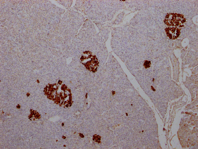 INS Antibody