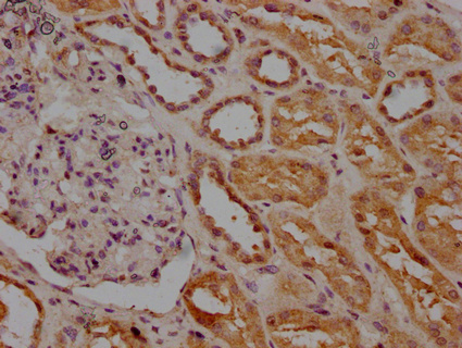 INSRR Antibody