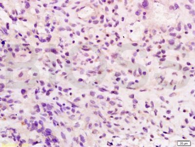 Integrin beta 7 Rabbit Polyclonal Antibody