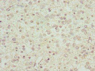 IFNA2 Antibody
