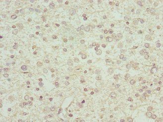 IFNA2 Antibody
