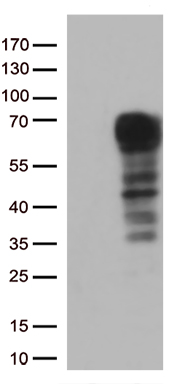 Interferon alpha 2 Antibody
