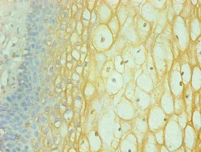 IFNG Antibody