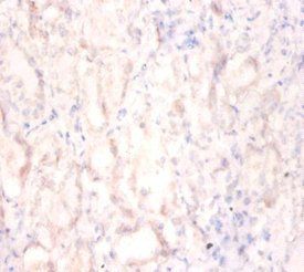 ILF2 Antibody