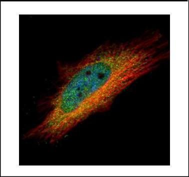 IP6K1 Rabbit Polyclonal Antibody