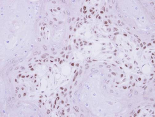 IP6K1 Rabbit Polyclonal Antibody