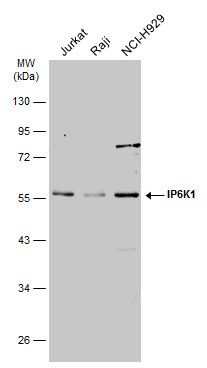 IP6K1 Rabbit Polyclonal Antibody