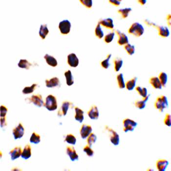 Ipaf Rabbit Polyclonal Antibody
