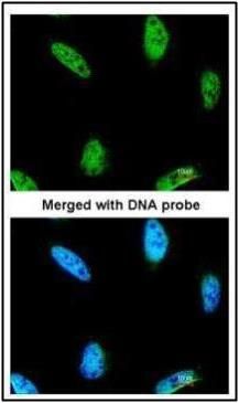 IPMK Rabbit Polyclonal Antibody