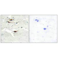 IPPK Antibody