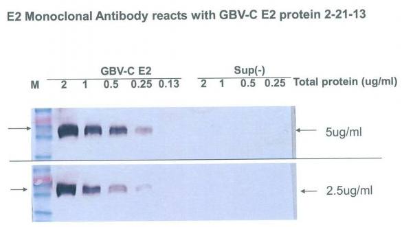 GBV-C virus glycoprotein E2 Monoclonal Antibody