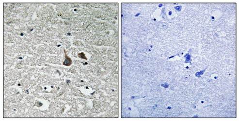 IRAK1 (Phospho-Ser376) Antibody