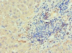 IRAK2 Antibody