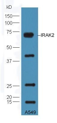 IRAK2 Rabbit Polyclonal Antibody