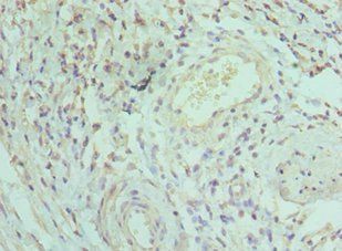 IRAK3 Antibody