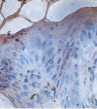 IRF9 Rabbit Polyclonal Antibody