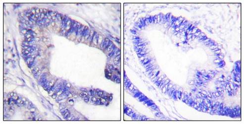 IRS-1 (Phospho-Ser1101) Antibody