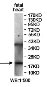 ISCU Rabbit Polyclonal Antibody