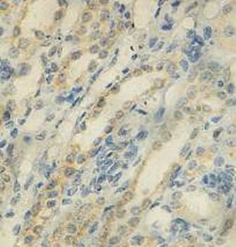 ISCU Rabbit Polyclonal Antibody