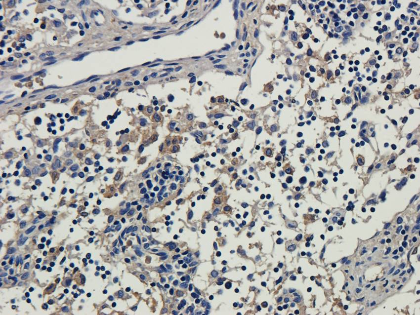 ISG15 Rabbit Polyclonal Antibody