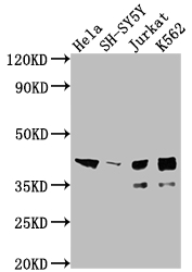 ISL1 Antibody