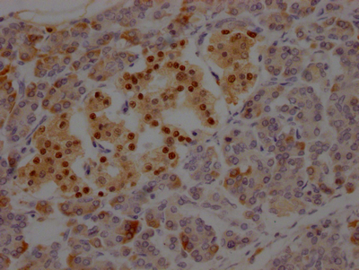 ISL1 Antibody