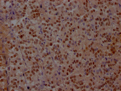 ISL1 Antibody